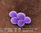 Integrated Biosciences discovers new class of antibiotics effective against resistant MRSA bacteria. (Source: Public Health Image Library #9994)