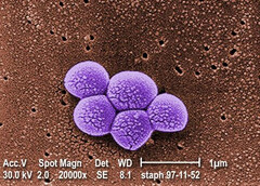 Integrated Biosciences discovers new class of antibiotics effective against resistant MRSA bacteria. (Source: Public Health Image Library #9994)