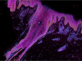 An image that demonstrates selected genes of interest in developing human skin. The cyan shades represent stem cells, orange stands for keratincoytes, and green + purple implies immune cells. (Image source: Wellcome Sanger Institute)