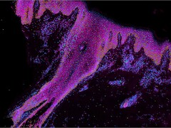 An image that demonstrates selected genes of interest in developing human skin. The cyan shades represent stem cells, orange stands for keratincoytes, and green + purple implies immune cells. (Image source: Wellcome Sanger Institute)