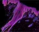 An image that demonstrates selected genes of interest in developing human skin. The cyan shades represent stem cells, orange stands for keratincoytes, and green + purple implies immune cells. (Image source: Wellcome Sanger Institute)