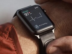 The KardiaBand is an ECG monitoring band designed for the Apple Watch. (Image source: Kardia)