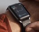 The KardiaBand is an ECG monitoring band designed for the Apple Watch. (Image source: Kardia)