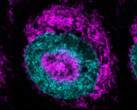 A confined cancer cell (pictured) - the magenta-colored mitochondria can be seen accumulating at the cyan-colored nuclear periphery and within nuclear indentations. (Image/caption source: Rito Ghose and Fabio Pezzano/Centro de Regulación Genómica)