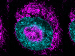 A confined cancer cell (pictured) - the magenta-colored mitochondria can be seen accumulating at the cyan-colored nuclear periphery and within nuclear indentations. (Image/caption source: Rito Ghose and Fabio Pezzano/Centro de Regulación Genómica)