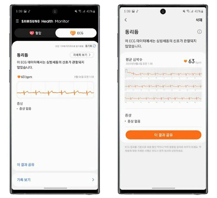 A Galaxy Note 20 device demos the new ECG function. (Source: TizenHelp)