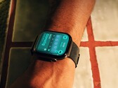 Some users have issues with skin irritation from the Apple Watch Series 12.