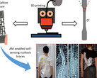 New scoliosis treatment research uses smart 3D-printed back brace to fix posture in children with spine deformity without surgery