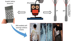 Adaptable 3D-printed back brace (image: University of Glasgow)