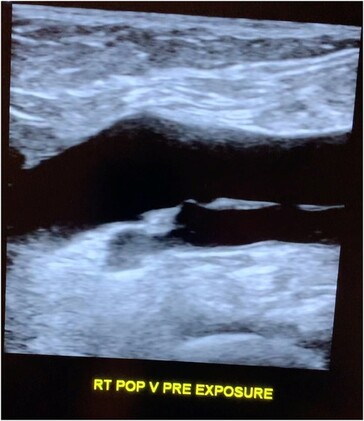 The patient's alleged venous ultrasound images before...