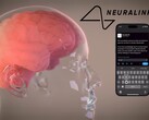 Neuralink's vision: complete control of digital devices by thinking (Image Source: Neuralink)