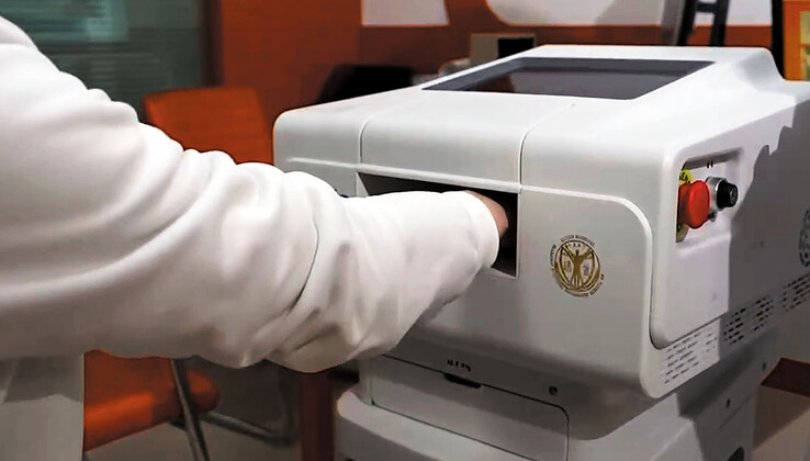 Only the patient's palm is required for blood glucose measurement. (Image source: China Daily)