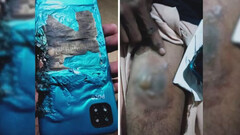 Poco C3 explodes. (Source: BNNewsTV)