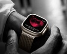 Apple's smartwatch sales are falling, in contrast to the sales of Huawei, Samsung and others. (Image source: Apple)