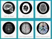 Darmiyan BrainSee medical AI software can detect signs of Alzheimer's early on. (Source: Darmiyan)