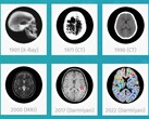 Darmiyan BrainSee medical AI software can detect signs of Alzheimer's early on. (Source: Darmiyan)