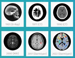 Darmiyan BrainSee medical AI software can detect signs of Alzheimer&#039;s early on. (Source: Darmiyan)