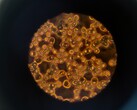 Blood cells under a microscope (Image source: ThisisEngineering via Unsplash; cropped)