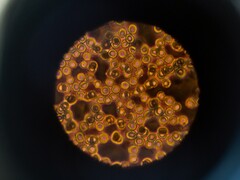 Blood cells under a microscope (Image source: ThisisEngineering via Unsplash; cropped)