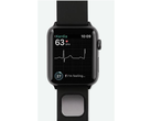 AliveCor's KardiaBand. (Source: AliveCor)