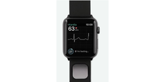 AliveCor&#039;s KardiaBand. (Source: AliveCor)