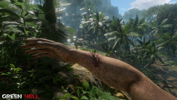 An image showing an injury in Green Hell.