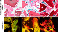 Living BioBone grafts (image: VA Ventures)