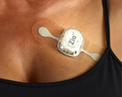 iRhythm Zio continuous, long-term ECG wearable detects cardiac arrhythmias as well as a doctor. (Source: iRhythm Technologies)
