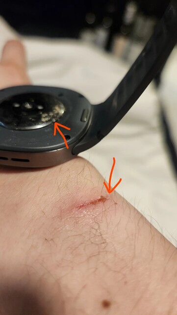 Galaxy Watch 8 burns through the skin on the wrist.