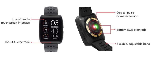 Masimo W1 watch is design for constant monitoring of SpO2 and other vitals. (Source: Masimo)