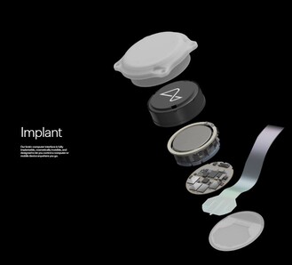 The various components of the Neuralink implant. (Source: Neuralink)