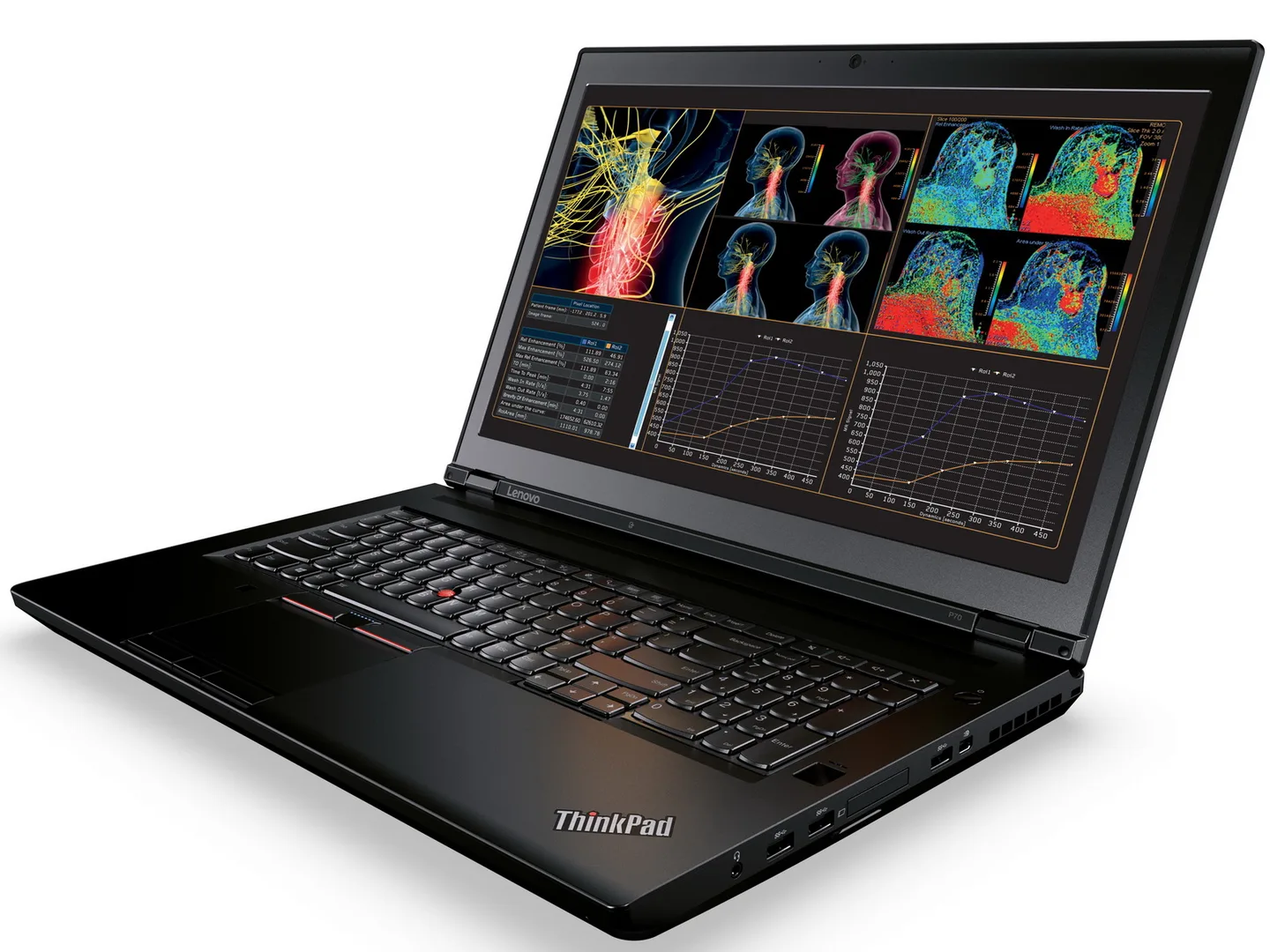 Thinkpad_P70_04-q82-w1440-h.webp